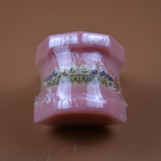 Модель челюсти с ортодонтическими брекетами ROZE Model Number :B3-01 for Dental study, teaching, stu