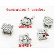 Generation 3 Self-ligating bracket CHN